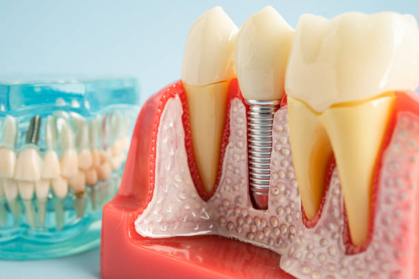 Oral Surgery in Bear Creek, FL